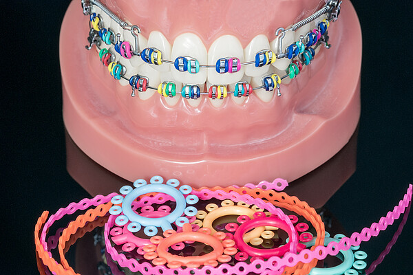 closeup, dentistry, dentist, orthodontic, model, dental, dentists, orthodontist, device, tooth, health, white, denture, braces, treatment, medical, bracket, background, clean, mirror, hygiene, clinic, traditional, healthcare, treat, laboratory, check, lab, mask, o-ring, object, jaw, stainless, professional, design, care, metal, background, demonstration, mouth, insurance, cost